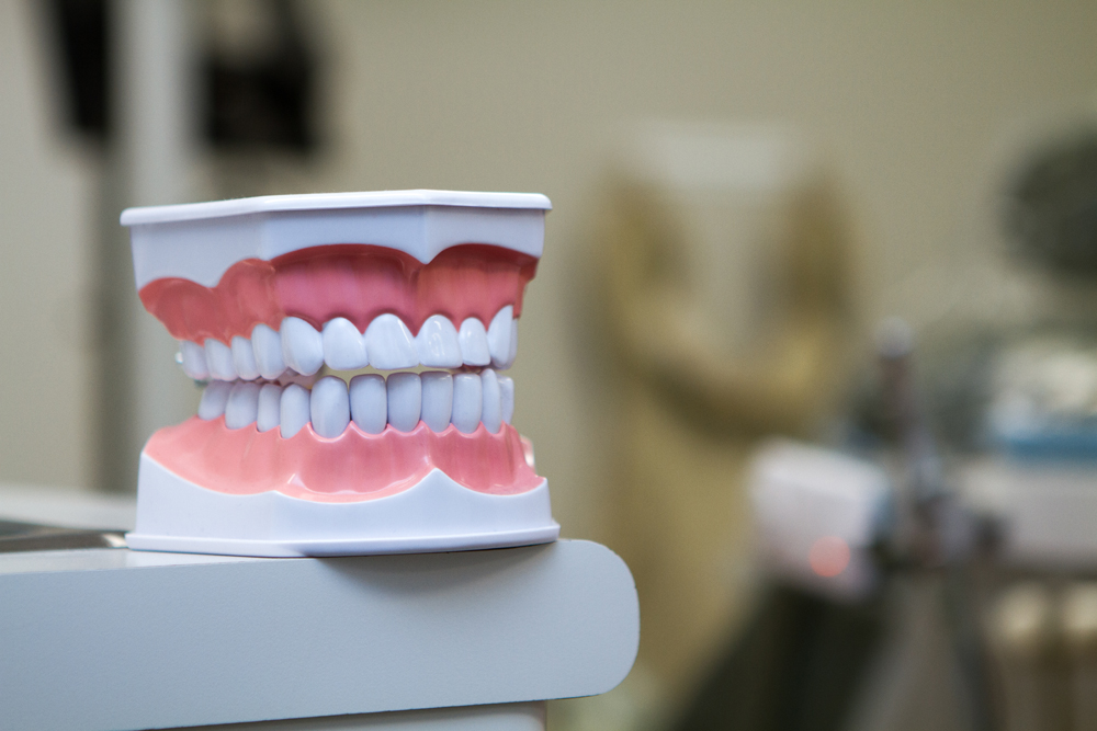 A close up of the teeth and gums on a model
